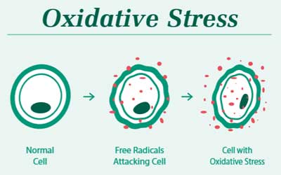 stress oksidatif