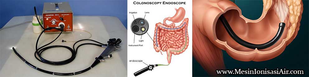 kolonoskopi endoskopi